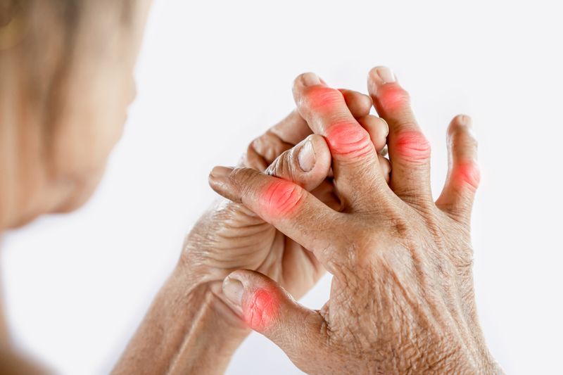 Relieves Arthritis Pain
