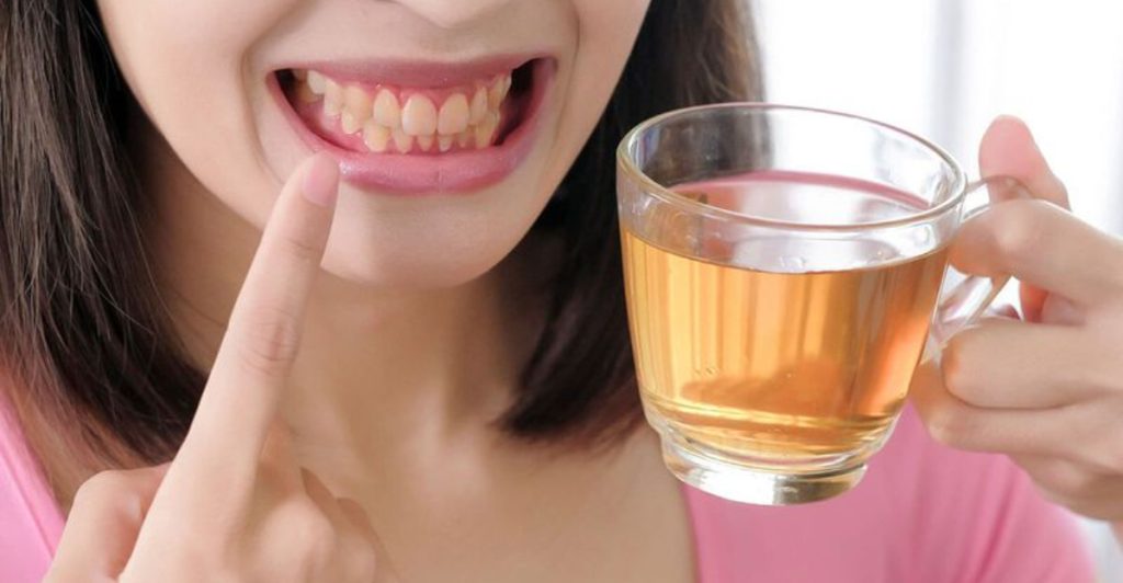 Yellow Smile Alert—20 Things You Eat and Drink That Stain Teeth