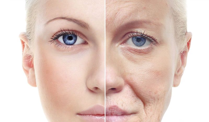 Premature Aging