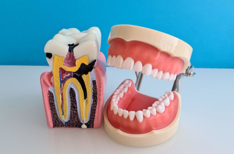 Cavities