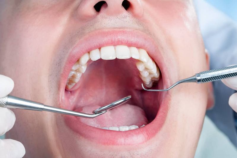 Dental Issues