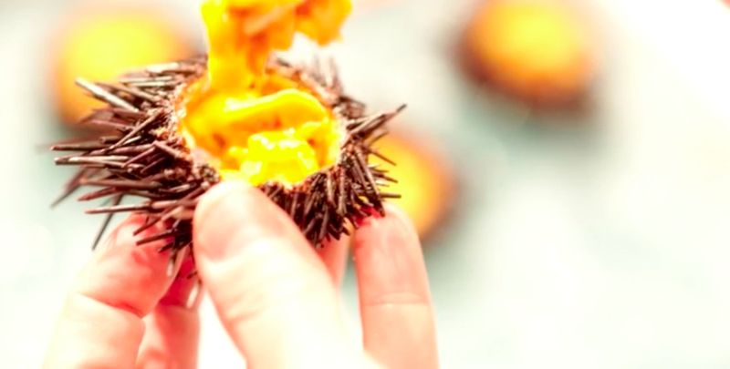 Uni